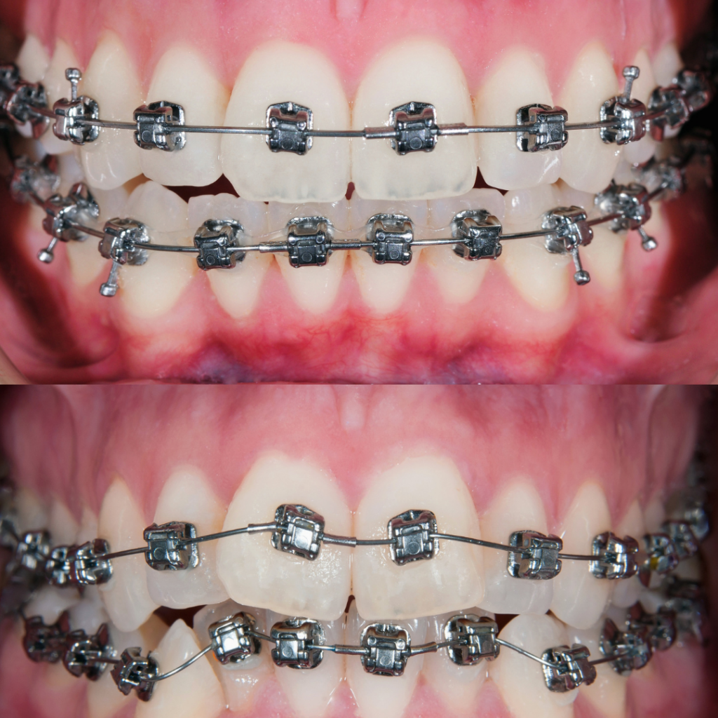 Dental Services Dental Day Spa